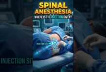 How Is Spinal Anesthesia Given? 💉3D Animation | How Doctors Give Spinal Anesthesia Before Surgery
